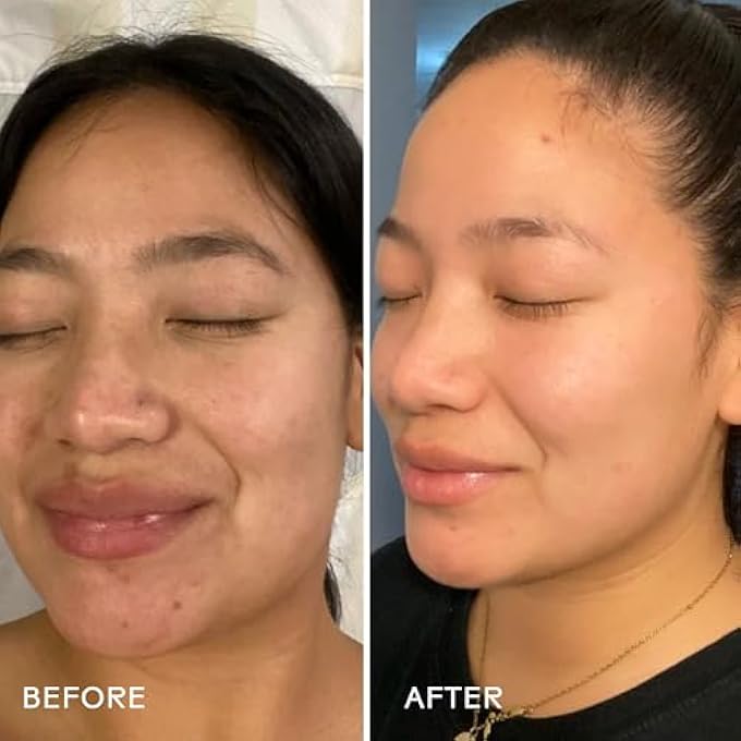 Three Ships DREAM SHOREA BUTTER REJUVENATING NIGHT CREAM WITH BIO-RETINOL - INTENSELY HYDRATES TO REVEAL BRIGHTER, SMOOTHER, EVEN TONED SKIN (50G) - Image 4